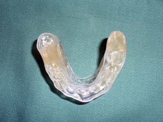 スリープスプリントの写真